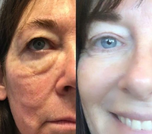 antiaging coach salon gold coast australia