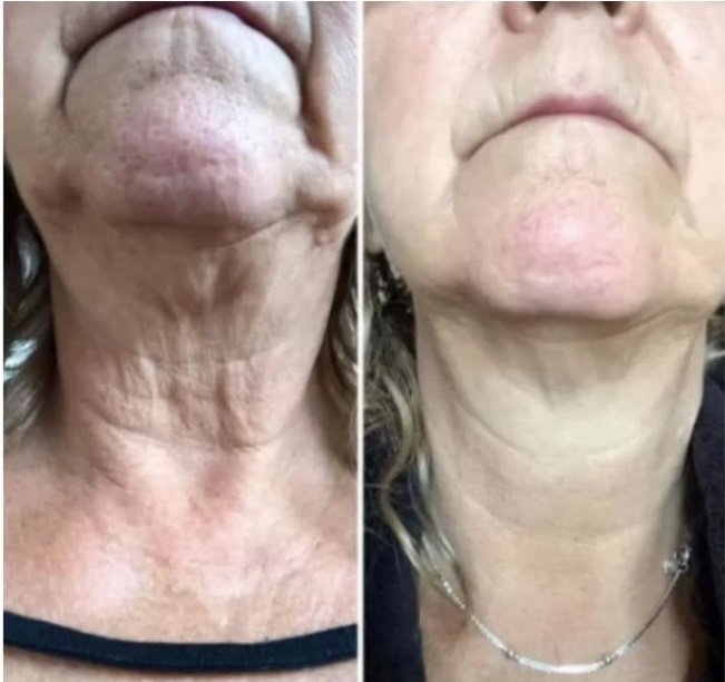liquid biocell collagen 